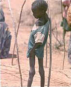 starving child